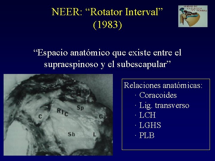 NEER: “Rotator Interval” (1983) “Espacio anatómico que existe entre el supraespinoso y el subescapular”