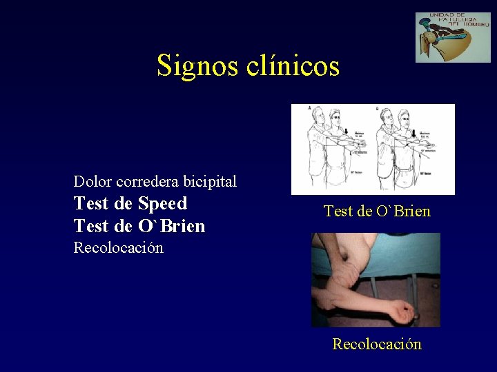 Signos clínicos Dolor corredera bicipital Test de Speed Test de O`Brien Recolocación 