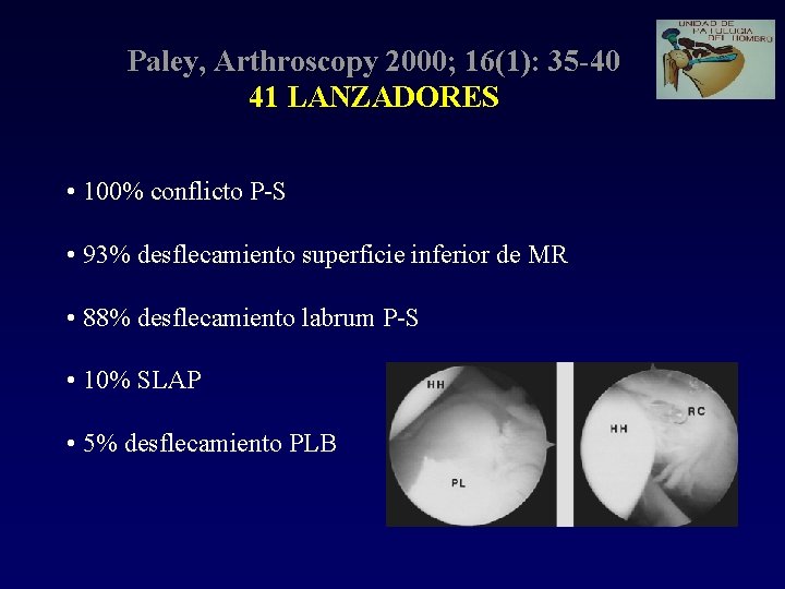 Paley, Arthroscopy 2000; 16(1): 35 -40 41 LANZADORES • 100% conflicto P-S • 93%