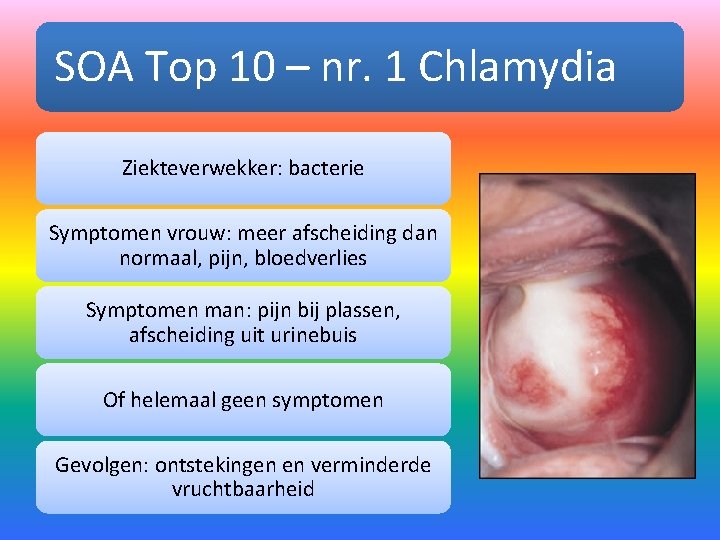 SOA Top 10 – nr. 1 Chlamydia Ziekteverwekker: bacterie Symptomen vrouw: meer afscheiding dan