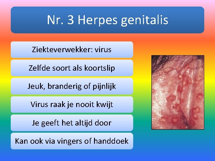 Nr. 3 Herpes genitalis Ziekteverwekker: virus Zelfde soort als koortslip Jeuk, branderig of pijnlijk