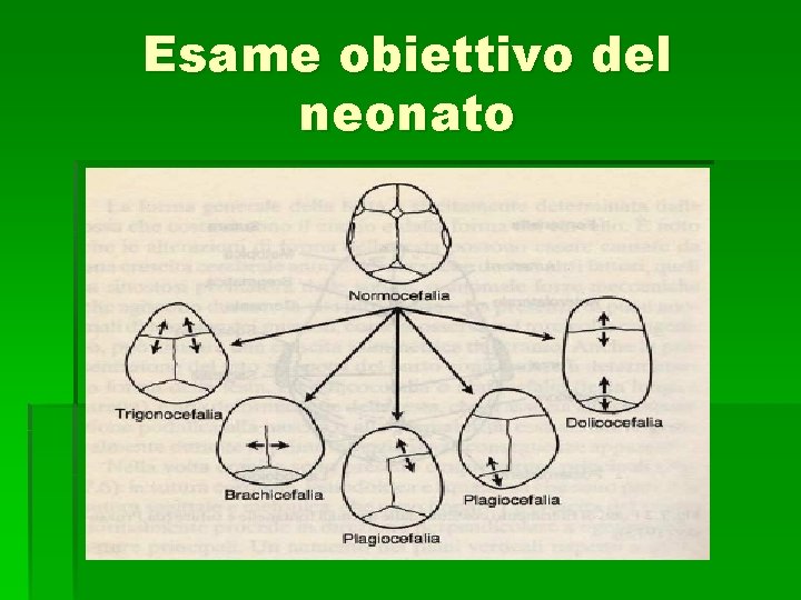 Esame obiettivo del neonato 