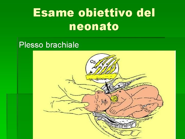 Esame obiettivo del neonato Plesso brachiale 