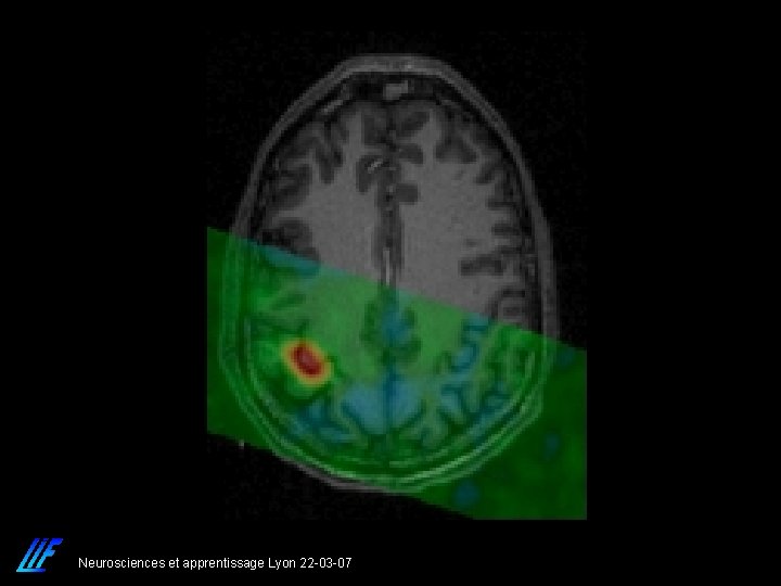 Neurosciences et apprentissage Lyon 22 -03 -07 