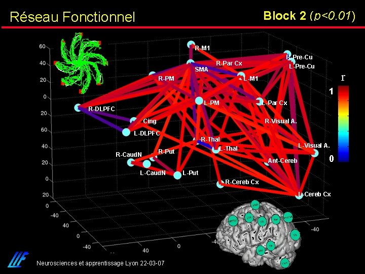 Block 2 (p<0. 01) Réseau Fonctionnel R-M 1 SMA R-Pre-Cu R-Par Cx R-PM L-Pre-Cu