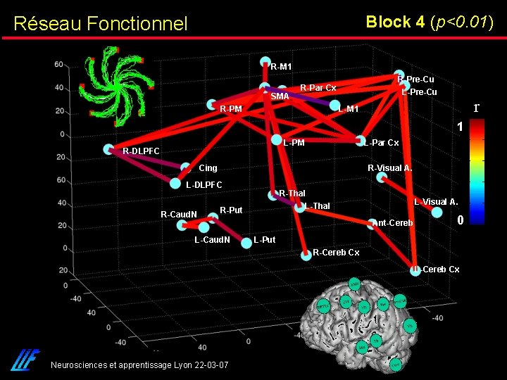 Block 4 (p<0. 01) Réseau Fonctionnel R-M 1 SMA R-Pre-Cu R-Par Cx R-PM L-Pre-Cu