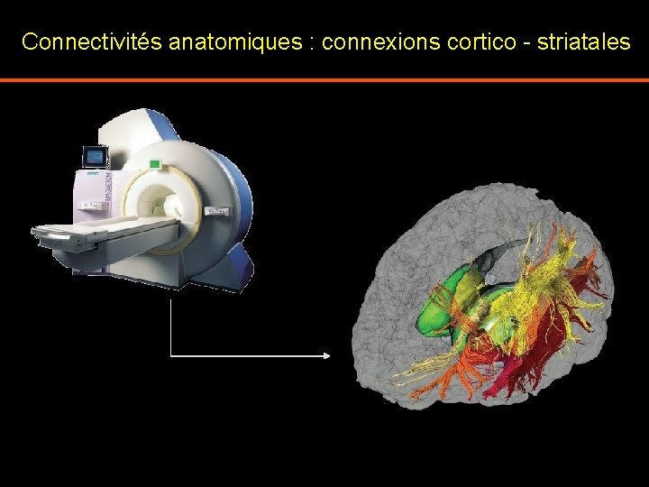 Connectivités anatomiques : connexions cortico - striatales 