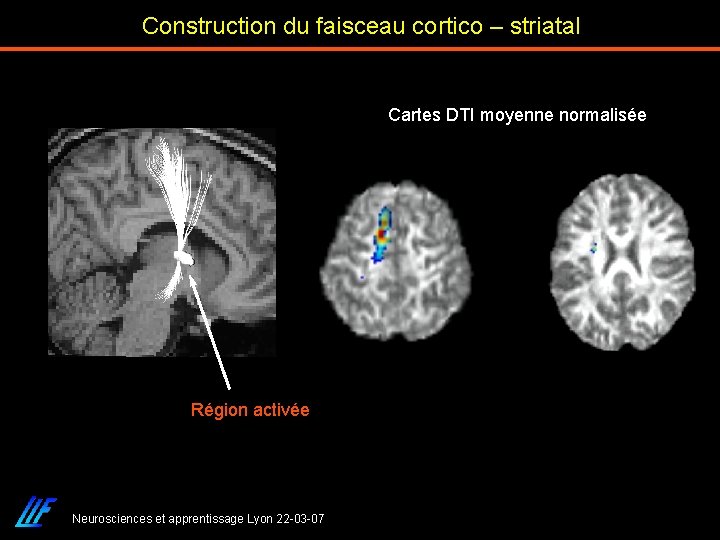 Construction du faisceau cortico – striatal Cartes DTI moyenne normalisée Région activée Neurosciences et