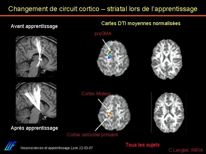 Changement de circuit cortico – striatal lors de l’apprentissage Cartes DTI moyennes normalisées Avant