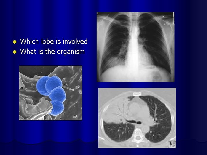 Which lobe is involved l What is the organism l 