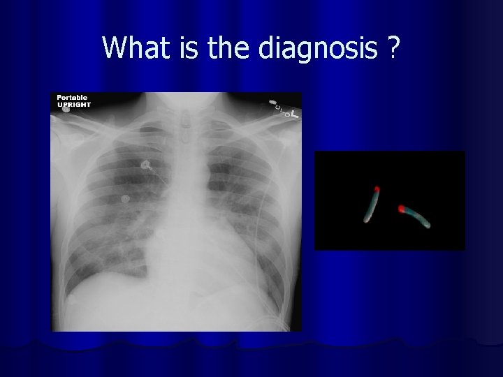 What is the diagnosis ? 