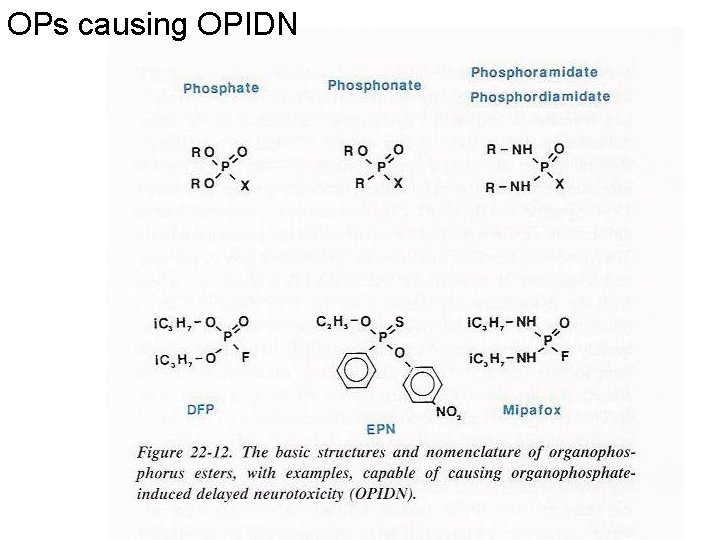 OPs causing OPIDN 