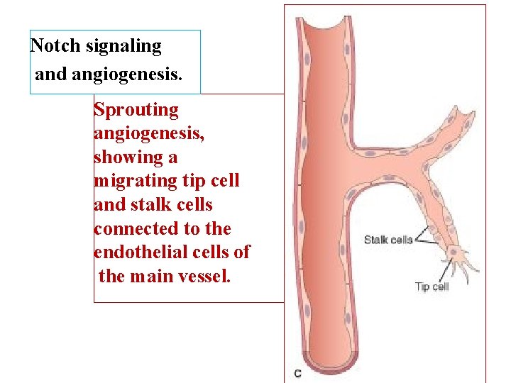 Notch signaling and angiogenesis. Sprouting angiogenesis, showing a migrating tip cell and stalk cells