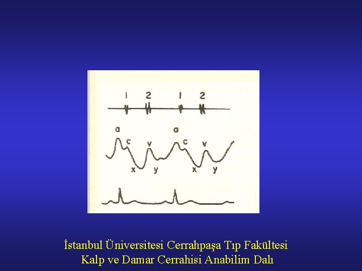 İstanbul Üniversitesi Cerrahpaşa Tıp Fakültesi Kalp ve Damar Cerrahisi Anabilim Dalı 
