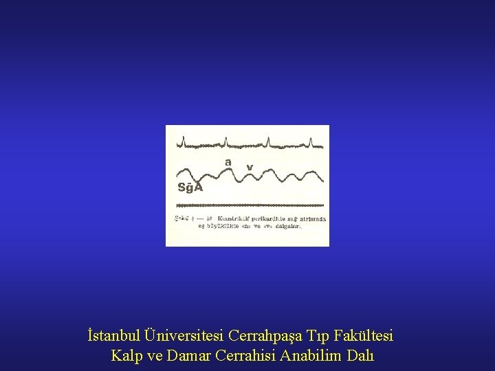 İstanbul Üniversitesi Cerrahpaşa Tıp Fakültesi Kalp ve Damar Cerrahisi Anabilim Dalı 