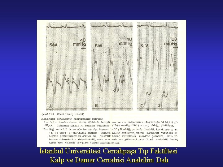İstanbul Üniversitesi Cerrahpaşa Tıp Fakültesi Kalp ve Damar Cerrahisi Anabilim Dalı 