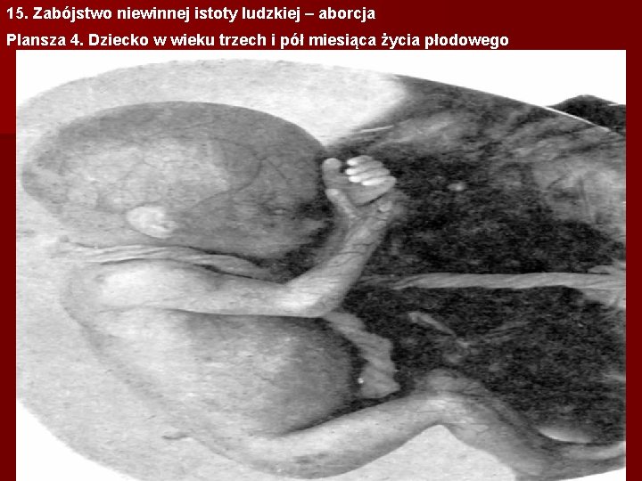 15. Zabójstwo niewinnej istoty ludzkiej – aborcja Plansza 4. Dziecko w wieku trzech i
