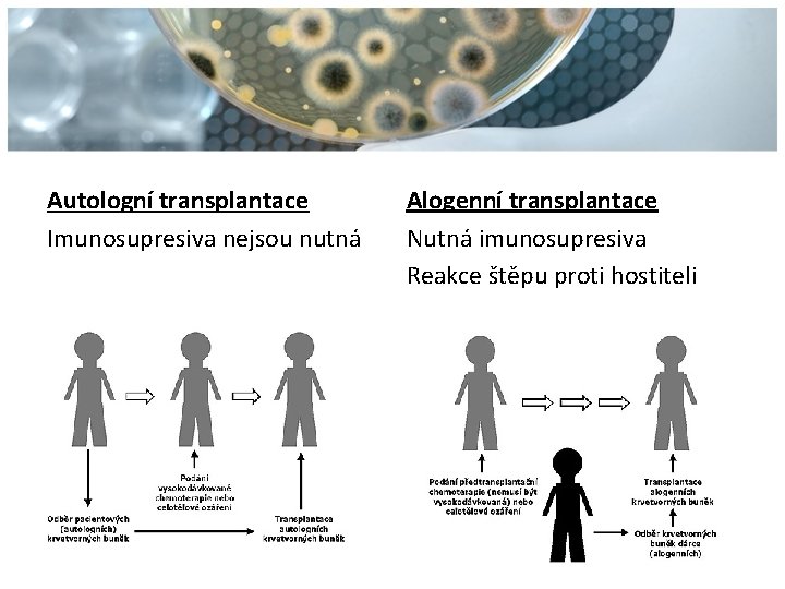 Autologní transplantace Imunosupresiva nejsou nutná Alogenní transplantace Nutná imunosupresiva Reakce štěpu proti hostiteli 