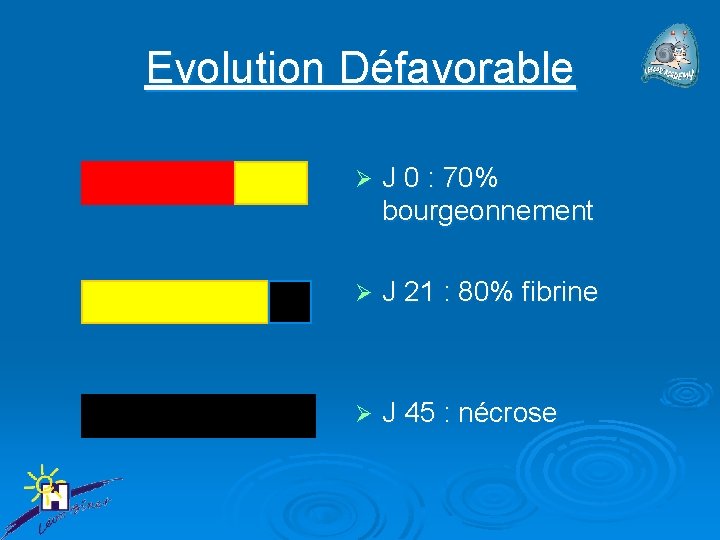 Evolution Défavorable Ø J 0 : 70% bourgeonnement Ø J 21 : 80% fibrine