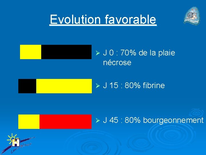 Evolution favorable Ø J 0 : 70% de la plaie nécrose Ø J 15