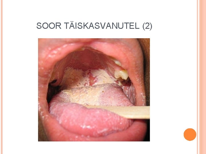 SOOR TÄISKASVANUTEL (2) 