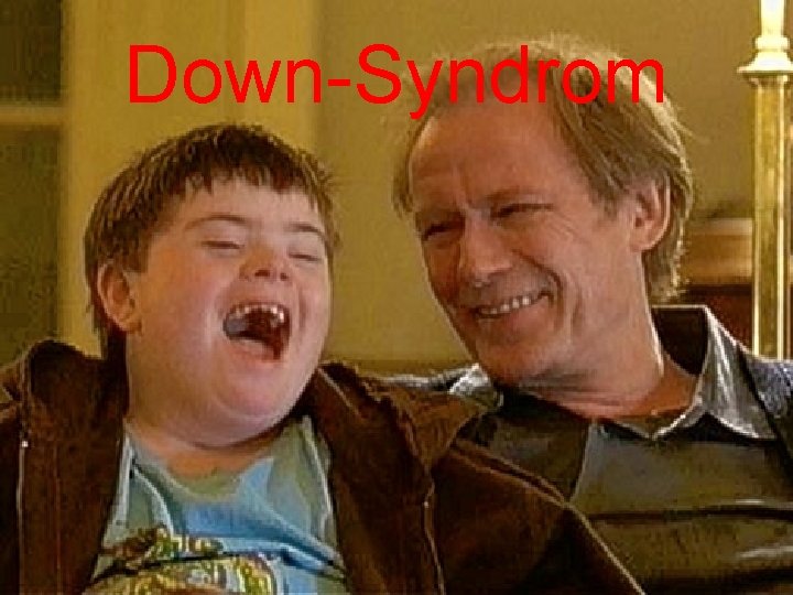 Down-Syndrom 