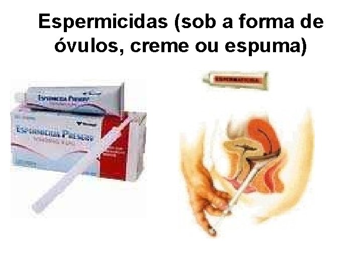 Espermicidas (sob a forma de óvulos, creme ou espuma) 