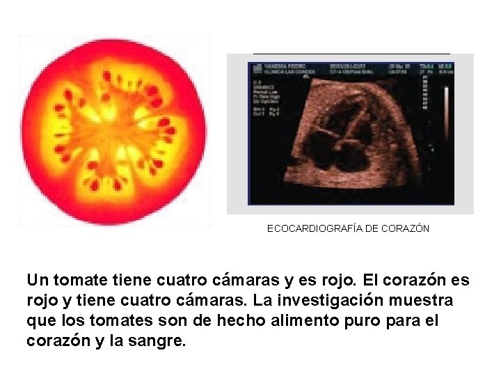 ECOCARDIOGRAFÍA DE CORAZÓN Un tomate tiene cuatro cámaras y es rojo. El corazón es