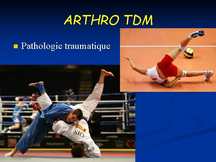 ARTHRO TDM n Pathologie traumatique 