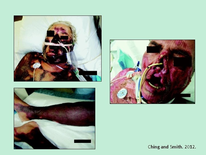 Ching and Smith. 2012. 