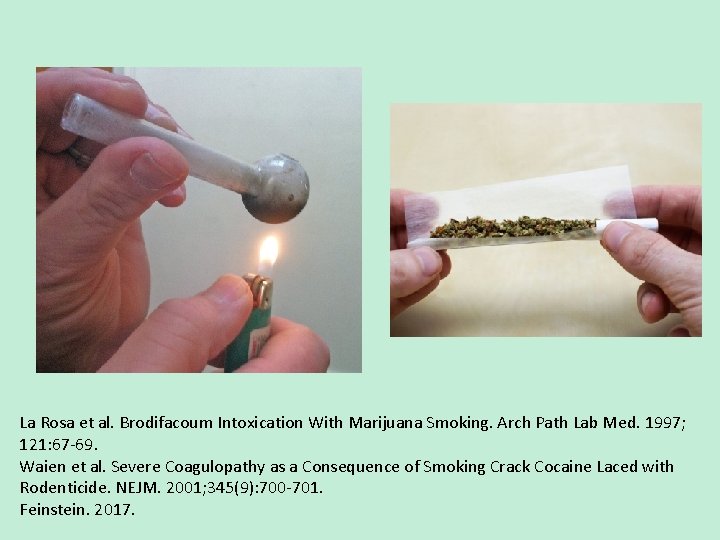 La Rosa et al. Brodifacoum Intoxication With Marijuana Smoking. Arch Path Lab Med. 1997;