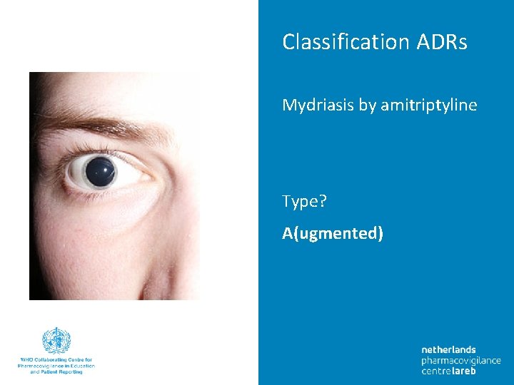 Classification ADRs • Text Mydriasis by amitriptyline • Text Type? A(ugmented) 