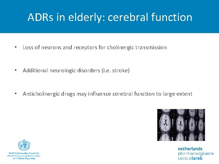 ADRs in elderly: cerebral function • Loss of neurons and receptors for cholinergic transmission