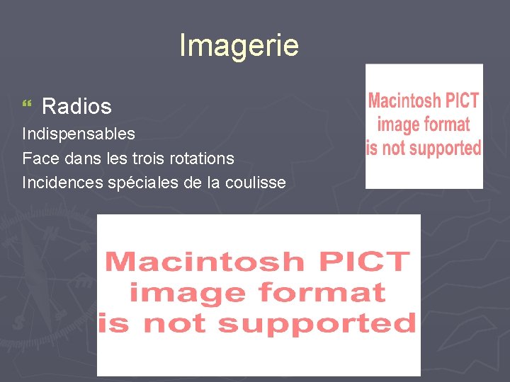 Imagerie } Radios Indispensables Face dans les trois rotations Incidences spéciales de la coulisse