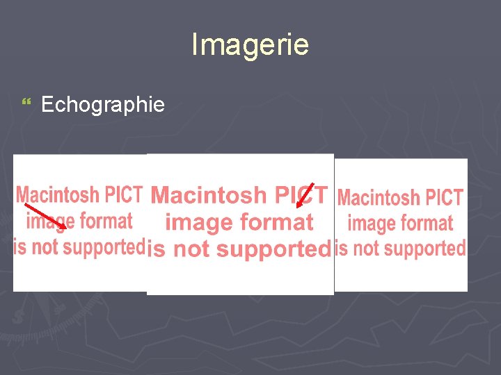 Imagerie } Echographie 