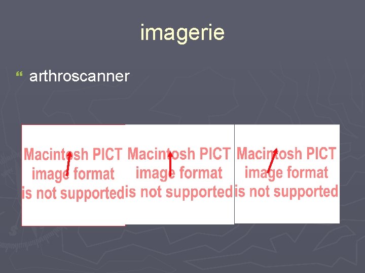 imagerie } arthroscanner 
