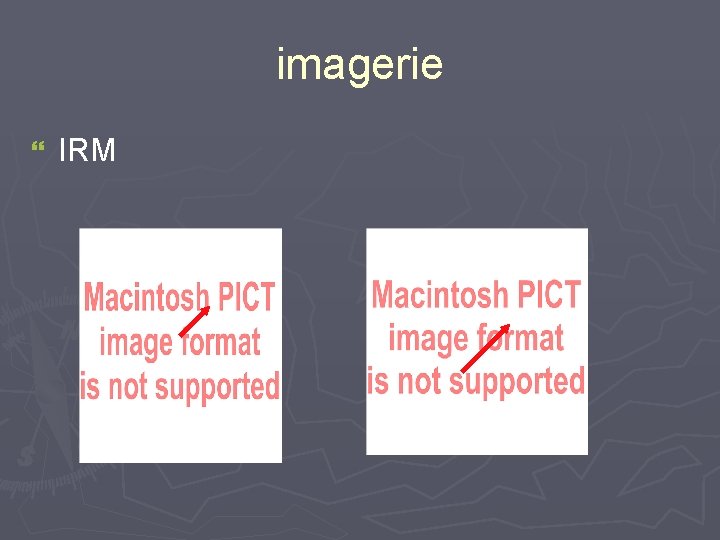 imagerie } IRM 
