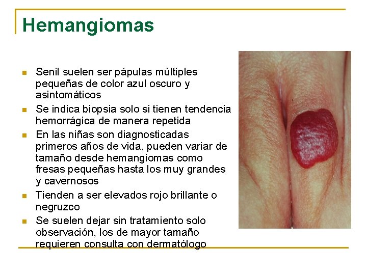 Hemangiomas n n n Senil suelen ser pápulas múltiples pequeñas de color azul oscuro