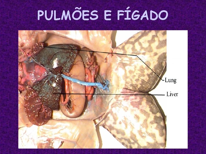 PULMÕES E FÍGADO 