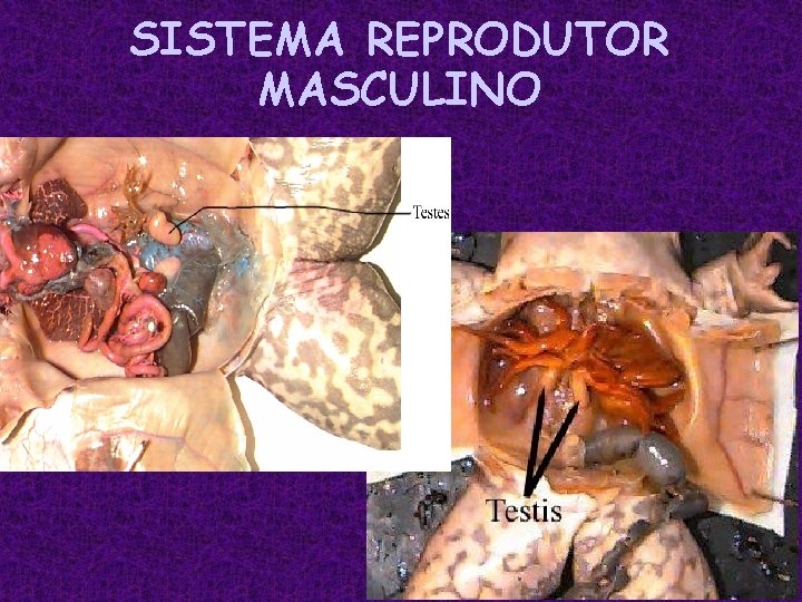 SISTEMA REPRODUTOR MASCULINO 