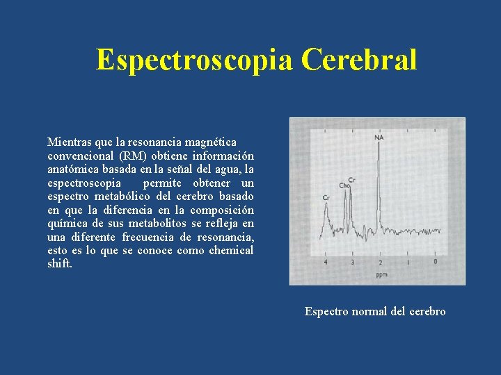 Espectroscopia Cerebral Mientras que la resonancia magnética convencional (RM) obtiene información anatómica basada en