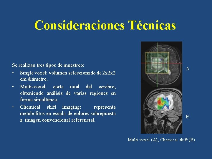 Consideraciones Técnicas Se realizan tres tipos de muestreo: • Single voxel: volumen seleccionado de