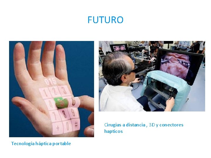 FUTURO Cirugias a distancia , 3 D y conectores hapticos Tecnología háptica portable 