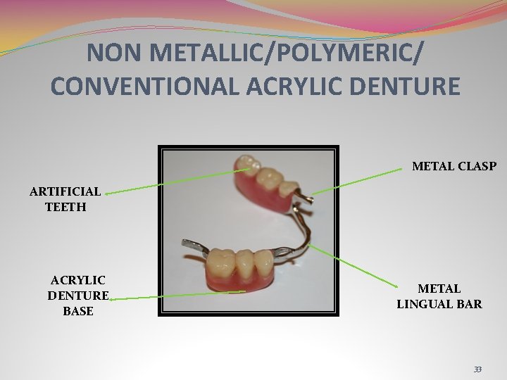 NON METALLIC/POLYMERIC/ CONVENTIONAL ACRYLIC DENTURE METAL CLASP ARTIFICIAL TEETH ACRYLIC DENTURE BASE METAL LINGUAL