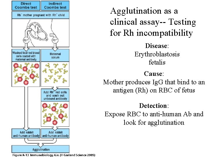 Agglutination as a clinical assay-- Testing for Rh incompatibility Disease: Erythroblastosis fetalis Cause: Mother