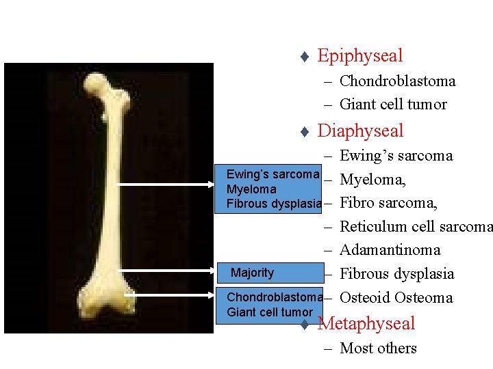 t Ewing’s sarcoma Myeloma Osteoid osteoma Epiphyseal – Chondroblastoma – Giant cell tumor t