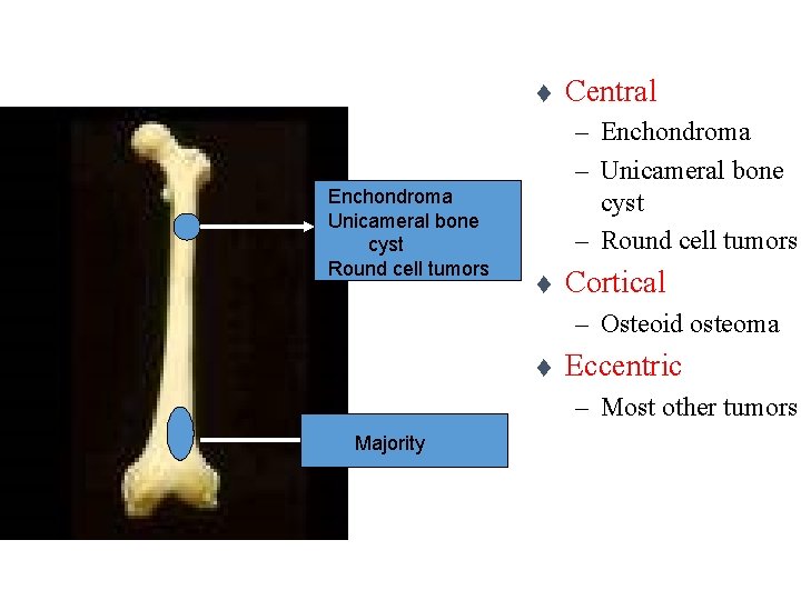 t Enchondroma Unicameral bone cyst Round cell tumors Central – Enchondroma – Unicameral bone