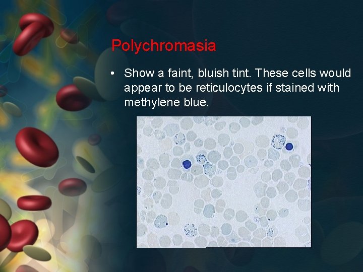Polychromasia • Show a faint, bluish tint. These cells would appear to be reticulocytes