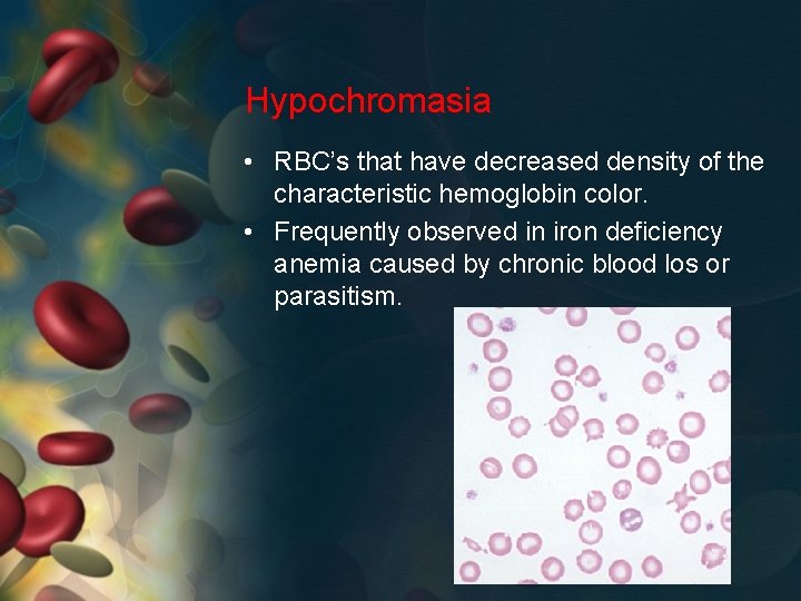 Hypochromasia • RBC’s that have decreased density of the characteristic hemoglobin color. • Frequently