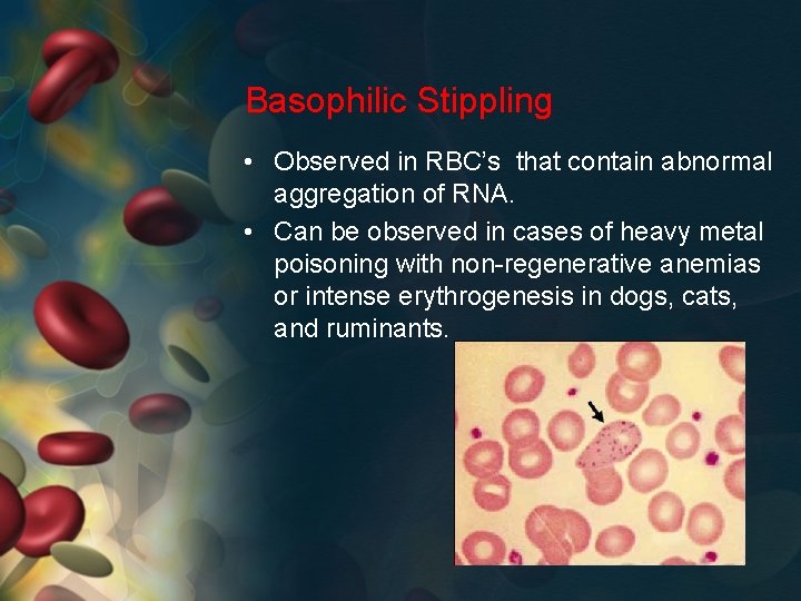 Basophilic Stippling • Observed in RBC’s that contain abnormal aggregation of RNA. • Can